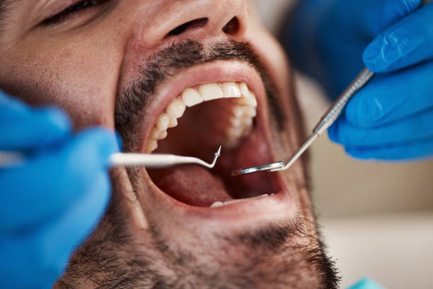 Best Emergency Root Canal Treatment in Fort Smith, AR