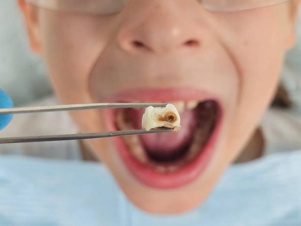 Best Same-Day Emergency Dentist in Fort Smith, AR